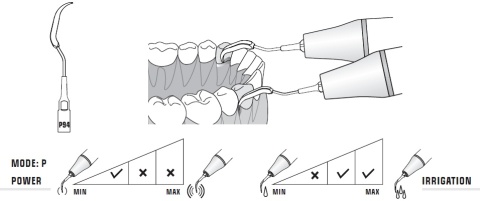 Końcówka do skalera P94 SPECIAL