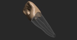 BIOMED 3D Tooth - Ząb treningowy - Centralny siekacz 1,4 mm otwarty wierzchołek