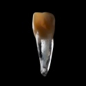 BIOMED 3D Tooth - Ząb treningowy - Centralny siekacz 1,4 mm otwarty wierzchołek